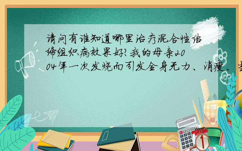 请问有谁知道哪里治疗混合性结缔组织病效果好?我的母亲2004年一次发烧而引发全身无力、消瘦、当时没有在意,半年来病症越来越严重,后经沈阳陆军总院确诊为混合性结缔组织病,住院治疗