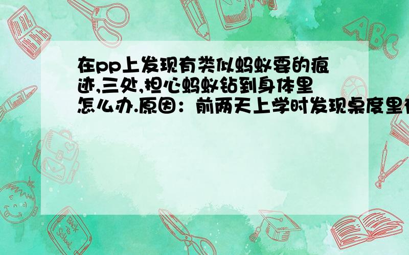 在pp上发现有类似蚂蚁要的痕迹,三处,担心蚂蚁钻到身体里怎么办.原因：前两天上学时发现桌度里有好几只蚂蚁还爬的很快,不过都被我打死了,但地上还有好几只,我怕它跑到凳子上,转到而我