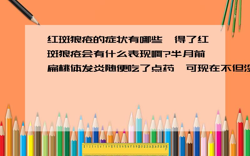 红斑狼疮的症状有哪些,得了红斑狼疮会有什么表现啊?半月前扁桃体发炎随便吃了点药,可现在不但没好,脸上开始出现一片片的红斑,不能确定是不是红斑狼疮的症状?我如果是得了红斑狼疮会