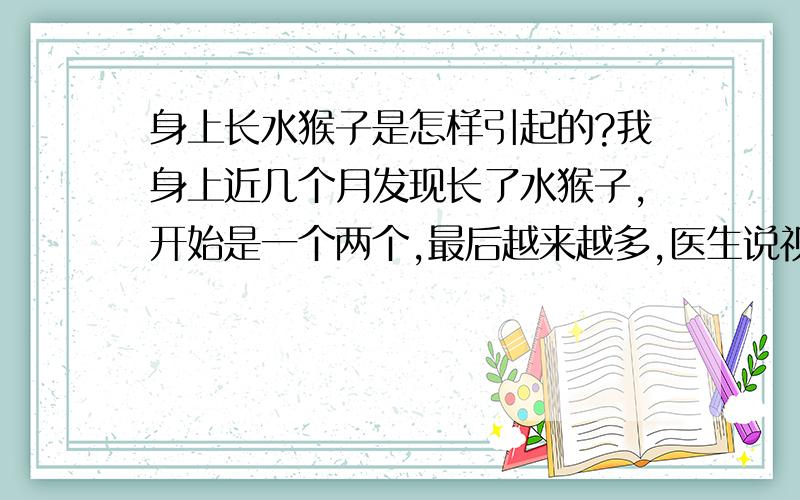 身上长水猴子是怎样引起的?我身上近几个月发现长了水猴子,开始是一个两个,最后越来越多,医生说视病毒性感染,我不明白病毒性感染是怎么回事,是什么原因引起的啊?