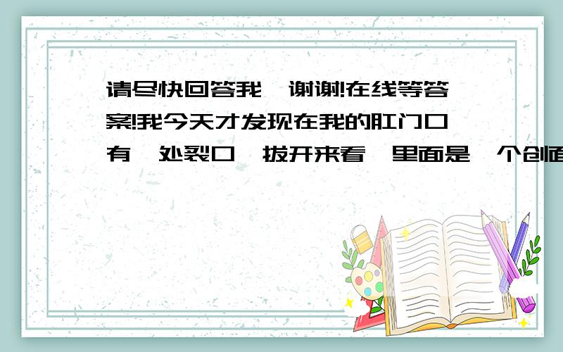 请尽快回答我,谢谢!在线等答案!我今天才发现在我的肛门口有一处裂口,拔开来看,里面是一个创面,但是平时没什么症状,我怀疑是肛裂,但是我大便也不干结,也不疼和流血,就是经常有想大便的