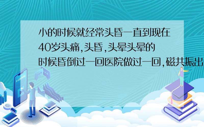 小的时候就经常头昏一直到现在40岁头痛,头昏,头晕头晕的时候昏倒过一回医院做过一回,磁共振出来是好的三十五岁开始有高血19岁开始有早搏我现在该怎样治疗头痛的