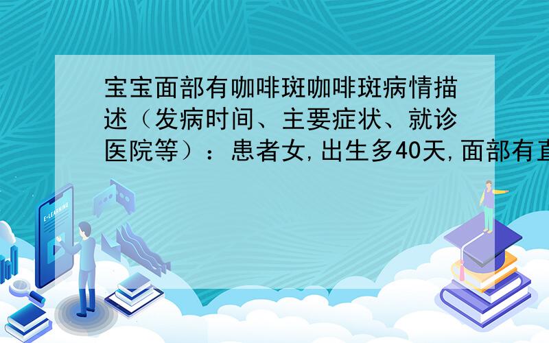 宝宝面部有咖啡斑咖啡斑病情描述（发病时间、主要症状、就诊医院等）：患者女,出生多40天,面部有直径1CM咖啡色斑块,出生就有,不突出于皮肤表面.曾经治疗情况和效果：尚未治疗想得到怎