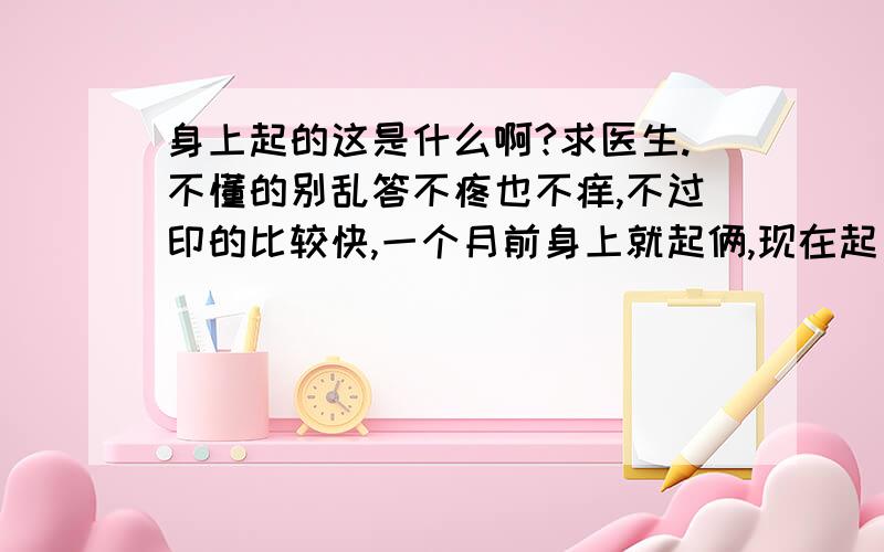 身上起的这是什么啊?求医生.不懂的别乱答不疼也不痒,不过印的比较快,一个月前身上就起俩,现在起了几十个了.