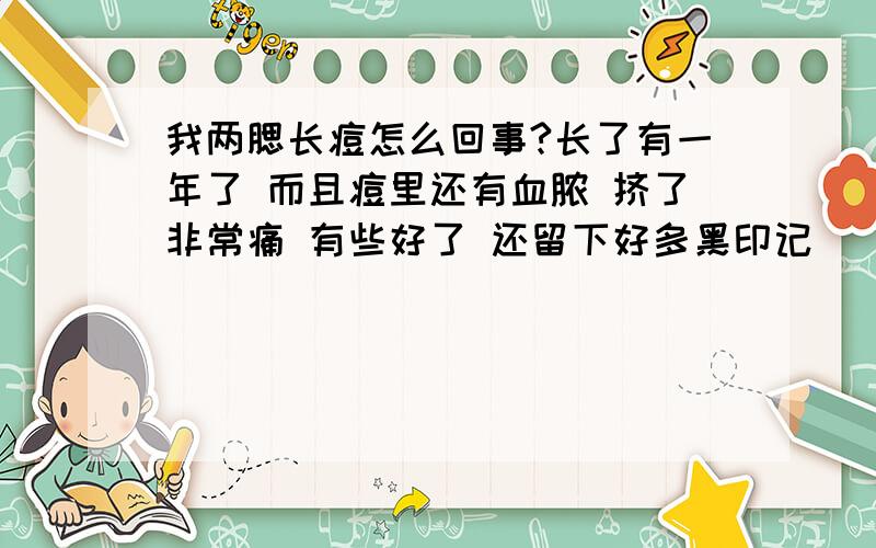 我两腮长痘怎么回事?长了有一年了 而且痘里还有血脓 挤了非常痛 有些好了 还留下好多黑印记