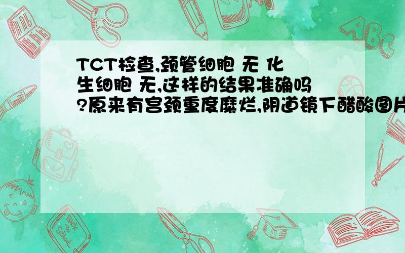 TCT检查,颈管细胞 无 化生细胞 无,这样的结果准确吗?原来有宫颈重度糜烂,阴道镜下醋酸图片有白斑,感染HPV值56.9.用了内服消炎药和保妇康栓一周,停药三天后做TCT检查.取样满意:颈管细胞 无