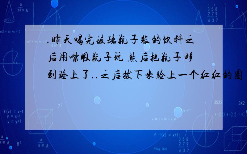 .昨天喝完玻璃瓶子装的饮料之后用嘴吸瓶子玩 然后把瓶子移到脸上了..之后拔下来脸上一个红红的圈 这怎么办.昨天喝完玻璃瓶子装的饮料之后用嘴吸瓶子玩 然后把瓶子移到脸上了..之后拔