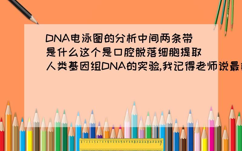 DNA电泳图的分析中间两条带是什么这个是口腔脱落细胞提取人类基因组DNA的实验,我记得老师说最前端的是DNA,有拖尾的是蛋白质杂质,那中间两条那么亮的是什么啊= =