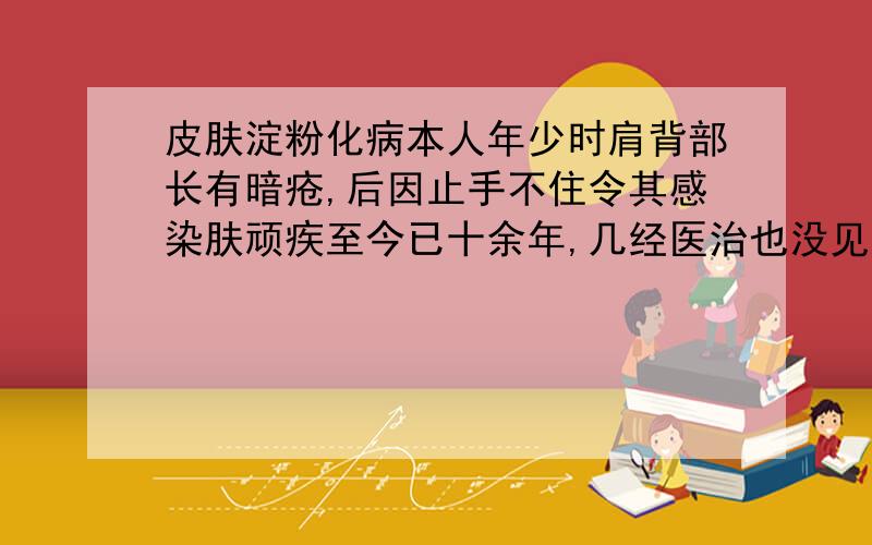 皮肤淀粉化病本人年少时肩背部长有暗疮,后因止手不住令其感染肤顽疾至今已十余年,几经医治也没见好转,得出检查结果是皮肤组织表皮角化过度上皮脚不规则延长,真皮乳增宽内有裂隙可见