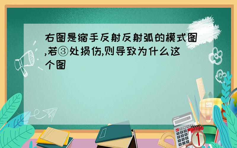 右图是缩手反射反射弧的模式图,若③处损伤,则导致为什么这个图