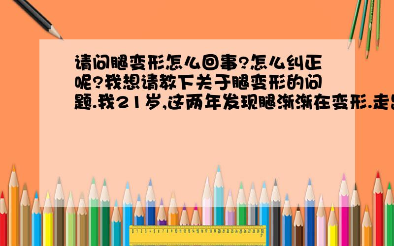 请问腿变形怎么回事?怎么纠正呢?我想请教下关于腿变形的问题.我21岁,这两年发现腿渐渐在变形.走路膝盖会相撞.腿并拢时,膝盖能并拢,大腿不能并拢.站在镜子前有点象x型.还有是怎么回事.