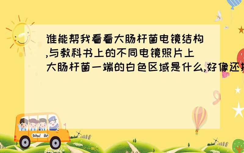 谁能帮我看看大肠杆菌电镜结构,与教科书上的不同电镜照片上大肠杆菌一端的白色区域是什么,好像还挺规整的我的大肠杆菌是野生的，自己分离得到的。包涵体应该是黑色的颗粒状吧？ 有