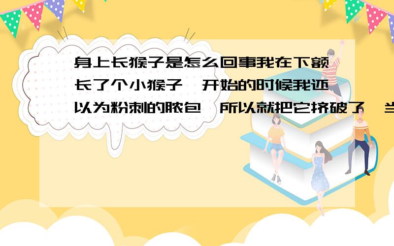 身上长猴子是怎么回事我在下额长了个小猴子,开始的时候我还以为粉刺的脓包,所以就把它挤破了,当时出了好多血,但后来才发现不是粉刺脓包而是个猴子.我想问一下有没有好的办法去除掉.