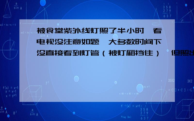 被食堂紫外线灯照了半小时,看电视没注意如题,大多数时间下没直接看到灯管（被灯厢挡住）,但照出来的灯光我能看见