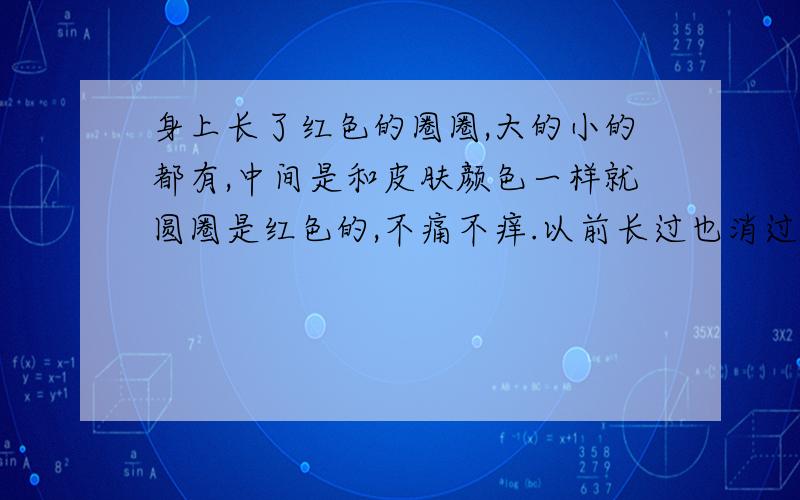 身上长了红色的圈圈,大的小的都有,中间是和皮肤颜色一样就圆圈是红色的,不痛不痒.以前长过也消过.