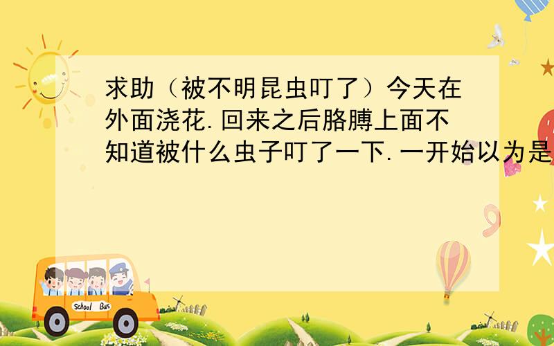 求助（被不明昆虫叮了）今天在外面浇花.回来之后胳膊上面不知道被什么虫子叮了一下.一开始以为是蚊子 后来发现被叮的包 越来越大 而且那个包非常烫 包的周围很痒 而且有扩散的趋势.